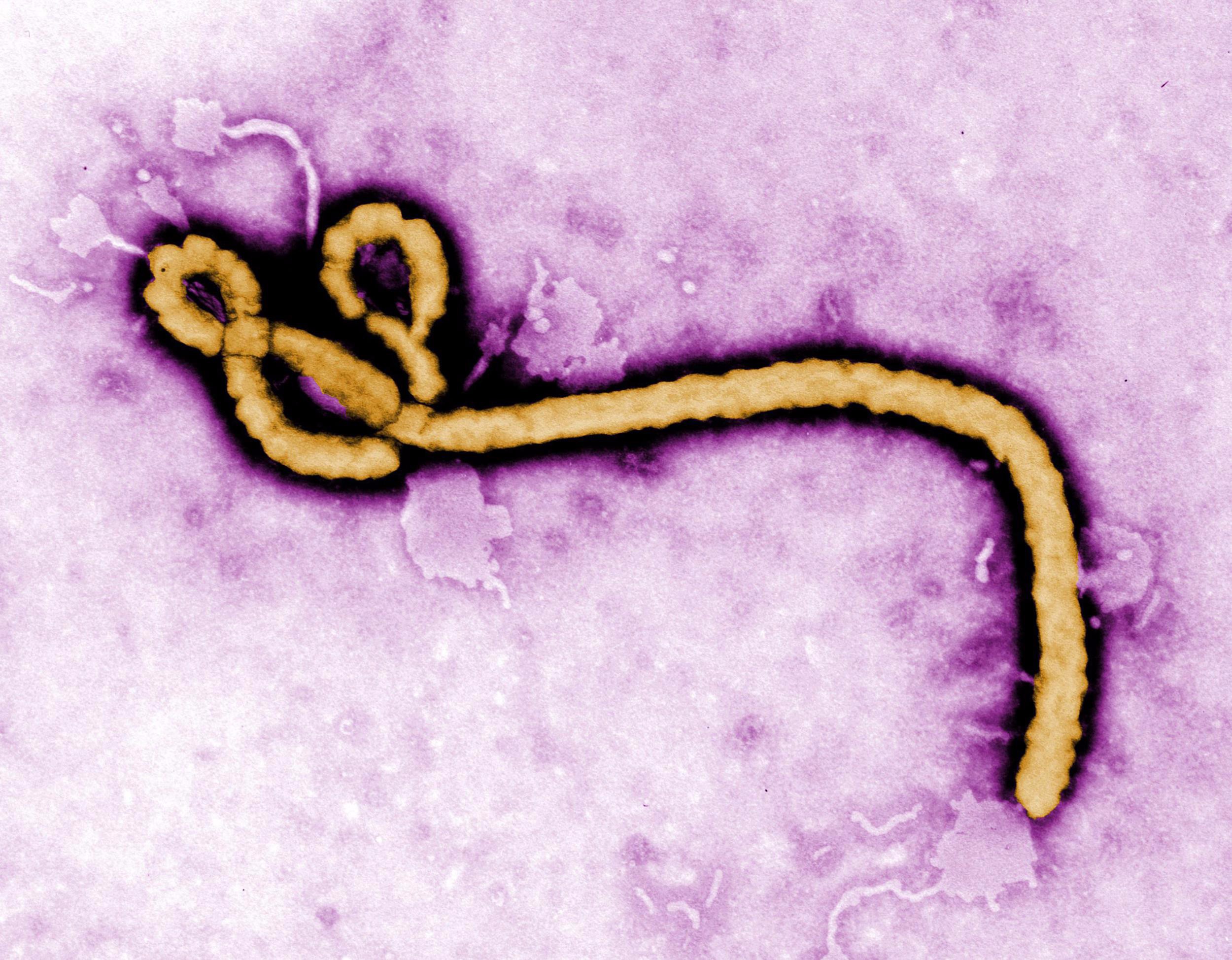 Wirus ebola. Fot. NBC News