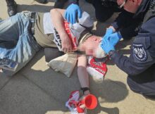 Mężczyzna wymagający pomocy Fot. Komenda Stołeczna Policji﻿